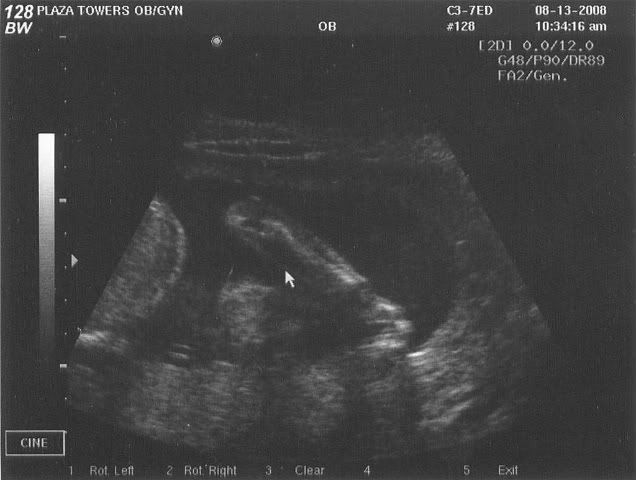 arm-21w5d
