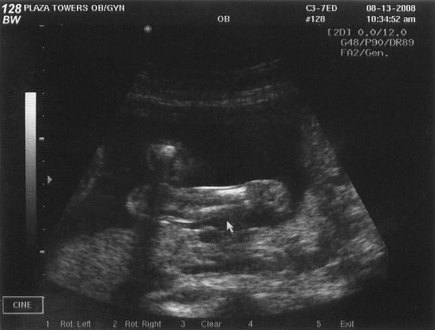 lower leg-21w5d