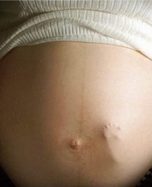 camel abortion photo: abortion pregnant.jpg