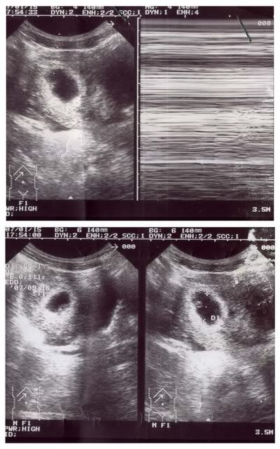 151.jpg 15.1.07 picture by anvicoi