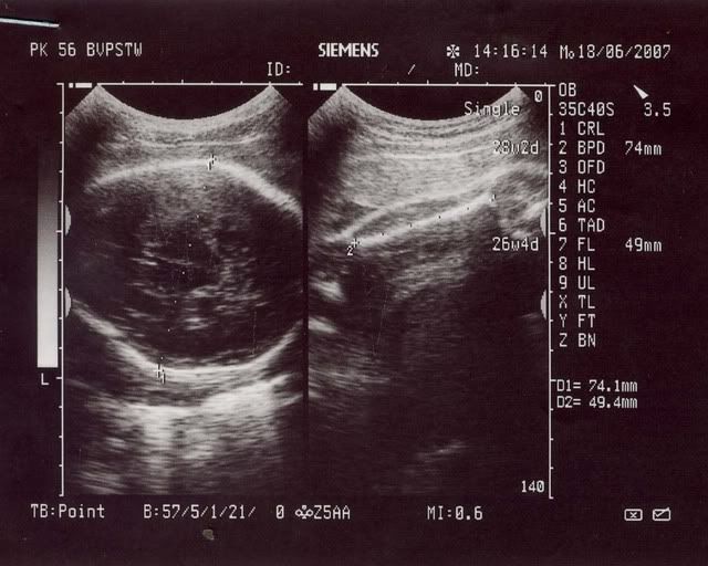 186.jpg 18.6.07 picture by anvicoi