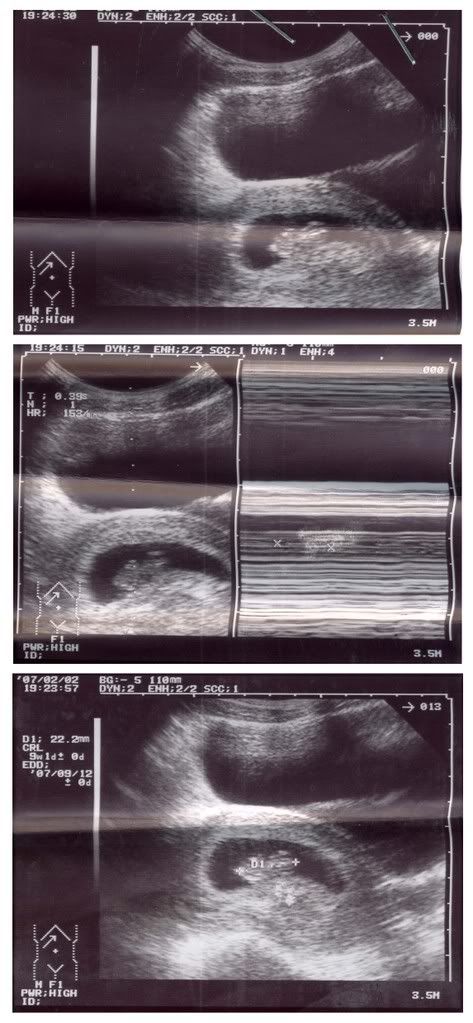 2.jpg 2.2.07 picture by anvicoi