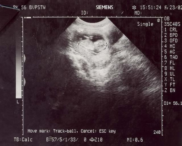 232-1.jpg 23.2 picture by anvicoi