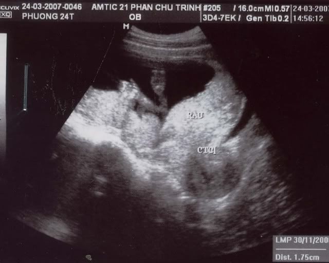 243.jpg 24.3.07 picture by anvicoi