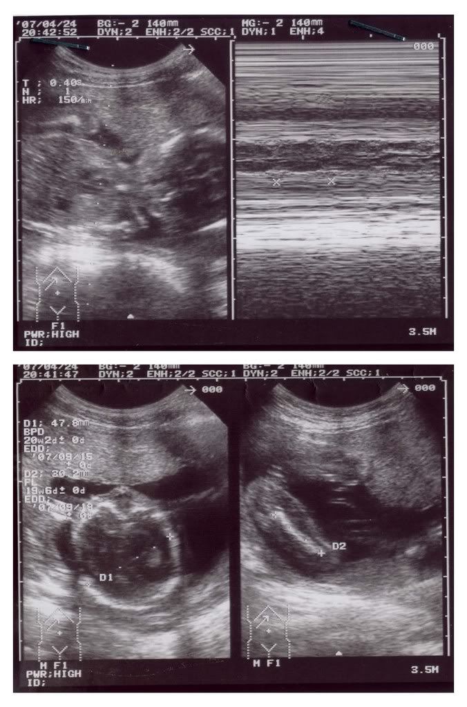 244.jpg 24.4.07 picture by anvicoi