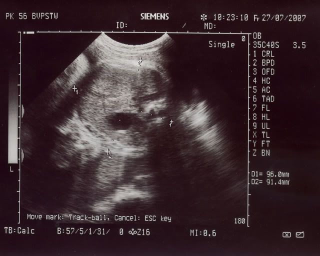 277.jpg 27.7.07 picture by anvicoi