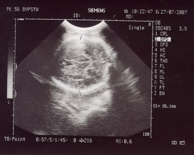 27707.jpg 27.7.07 picture by anvicoi