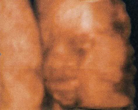 Untitled-12.jpg 11.5.07 picture by anvicoi