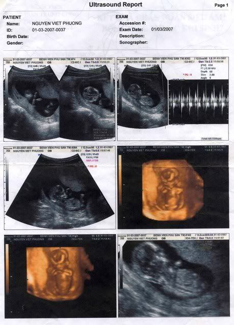 Untitled-7.jpg 1.3.07 picture by anvicoi